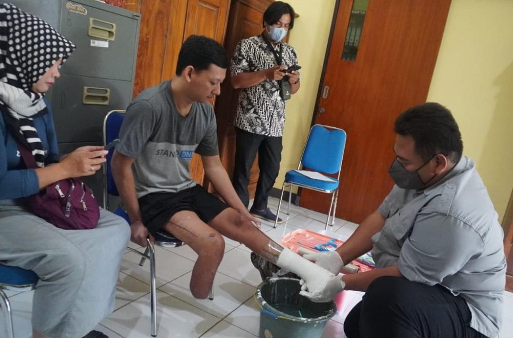 BERIKAN BANTUAN ALAT KAKI PALSU