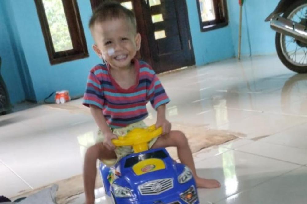 Dylan Balita di Batang, Derita Jantung Bocor Perlu Jalani Operasi