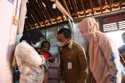 Bupati Batang Jenguk Balita Yang Tercebur Panci Panas Saat Bermain