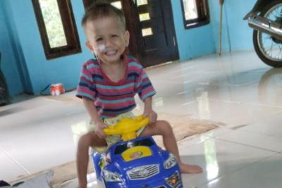Dylan Balita di Batang, Derita Jantung Bocor Perlu Jalani Operasi